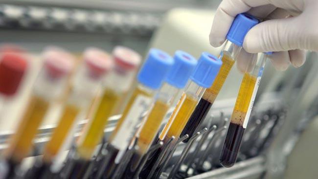 Number of coronavirus patients in Sri Lanka surges to 43