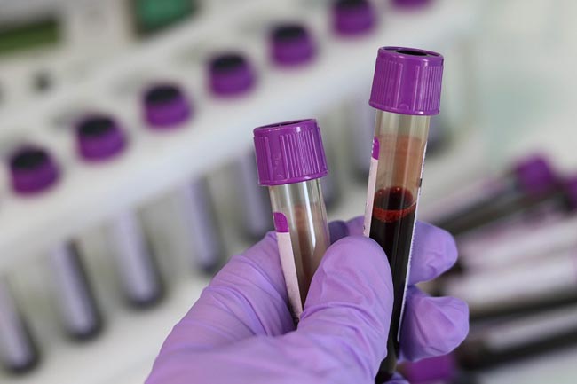 Two Navymen test positive for COVID-19; total at 1,047