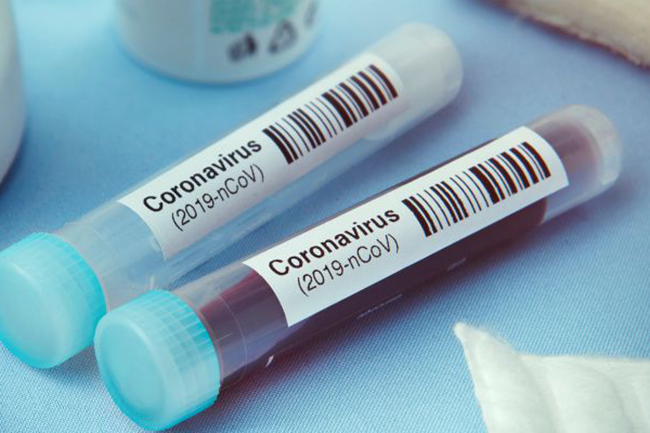 COVID-19: Two navy men test positive as cases tally climbs to 1,057