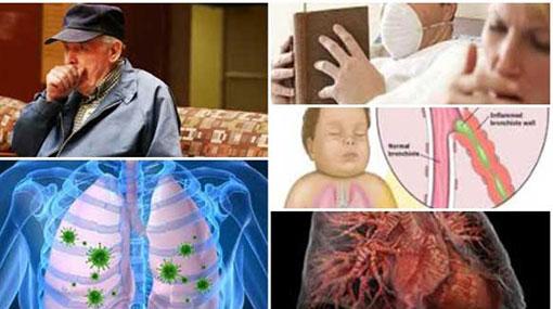 Cause for the viral flu spreading across Southern Province identified