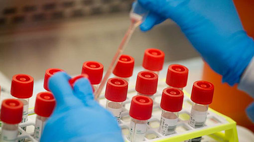 Eighteen more COVID-19 cases confirmed in Sri Lanka