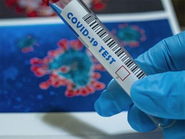 Six more Covid-19 cases moves total to 1,530