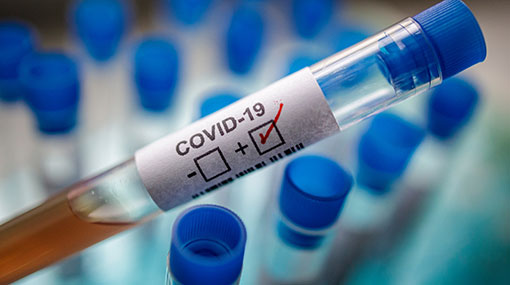One more positive Covid-19 case moves total to 1,649