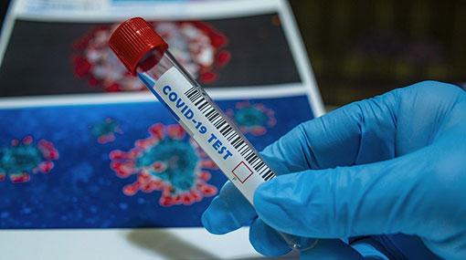 Two more Covid-19 cases moves total to 3,123