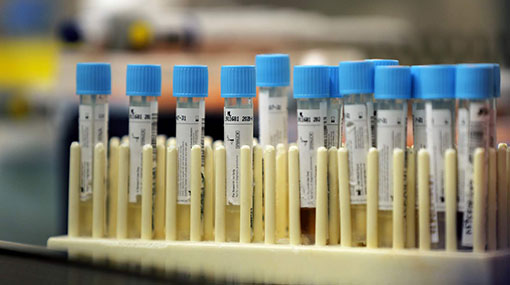 326 more test positive for Covid-19