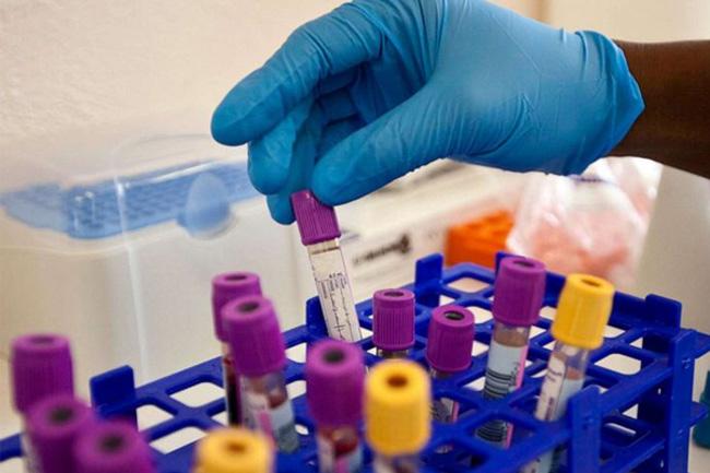Fifth person confirmed to be cured of HIV