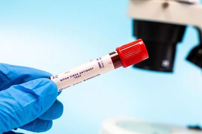 WHO sees low risk of Nipah virus spreading beyond India