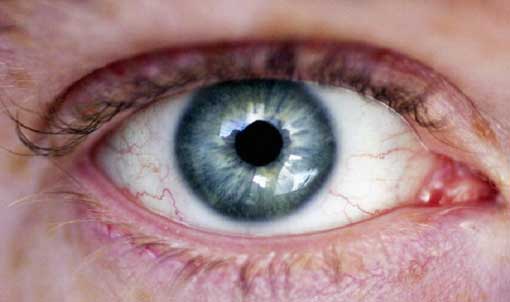 Sri Lankan-Pakistan Trade Association gifts corneas to people of Punjab