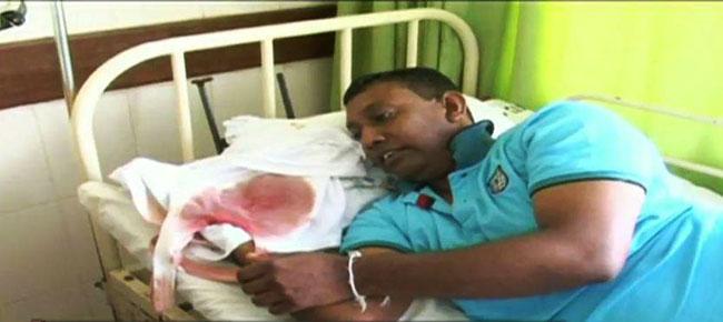 Student who assaulted teacher with wicket stump remanded