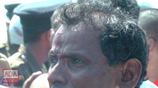 Twenty-one hospitalized after clashes in Hambantota