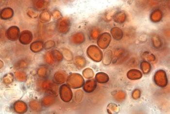 VIDEO:  Health Ministry identifies cause for ‘red rain’