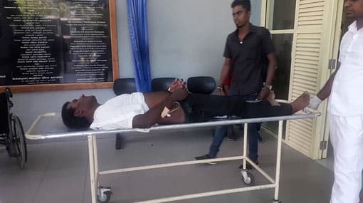 SLTB bus driver critically injured in assault