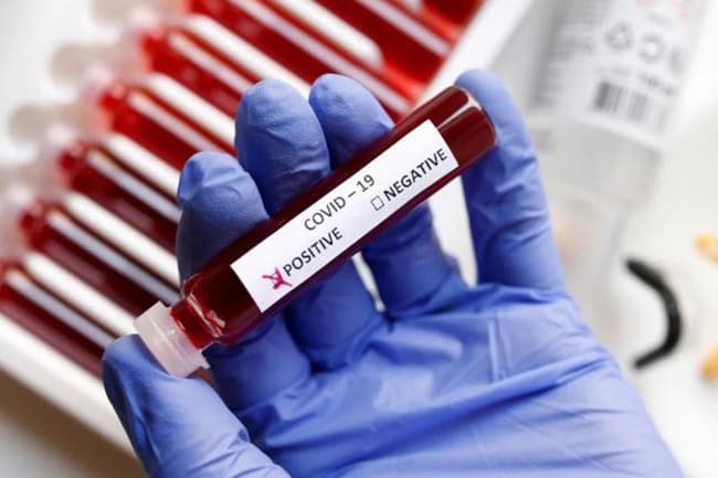Four COVID-19 patients add up to 248 total cases