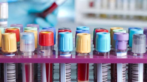 Coronavirus count in Sri Lanka climbs to 2,612