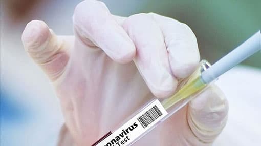 464 cases of Covid-19 reported so far today
