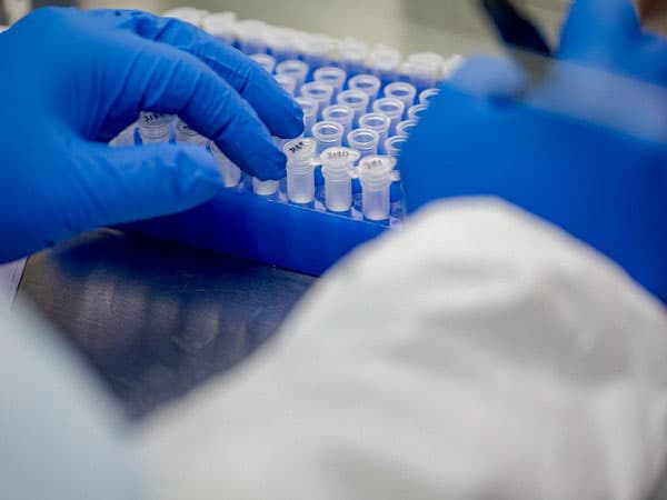 436 persons test positive for Covid-19 today