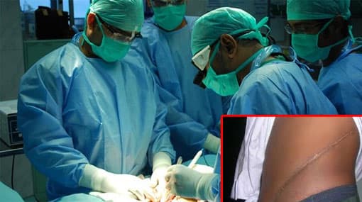 Kidneys removed from Indians – CCD informs Court