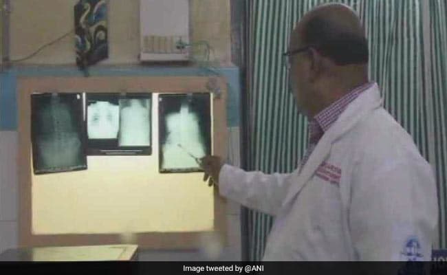 Sri Lankan tried to smuggle 14 gold biscuits inside rectum