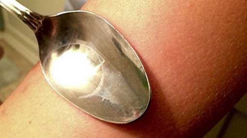 Mother burns 4-year-old using metal spoon