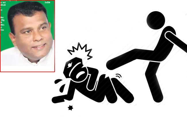 MP Shantha Abeysekara’s son assaults MSD officer