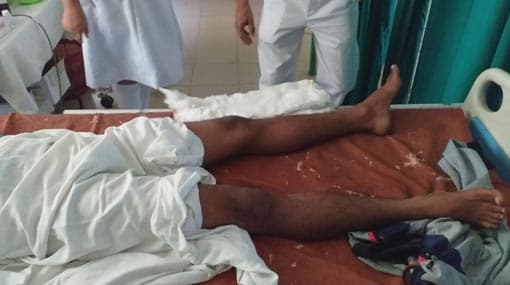 Father of two injured in assault by Ginigathhena police