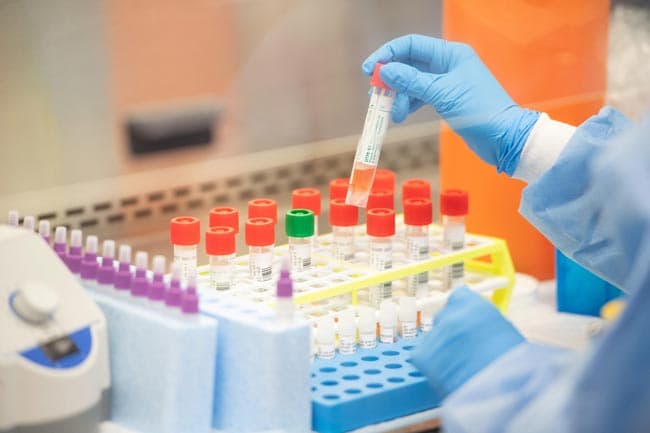 15 govt. hospitals recommended for treating COVID-19