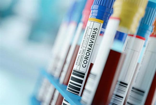 52 COVID-19 cases confirmed in Sri Lanka
