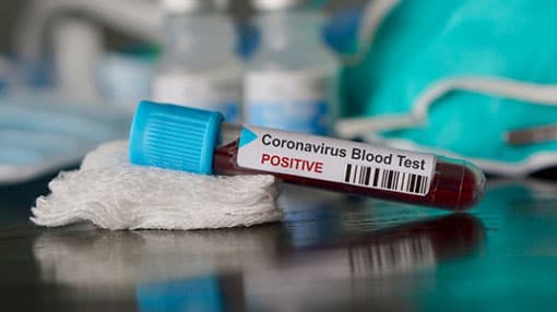 Coronavirus: 6 new cases reported, total climbs to 65