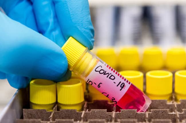 Sri Lanka records 77 positive coronavirus cases