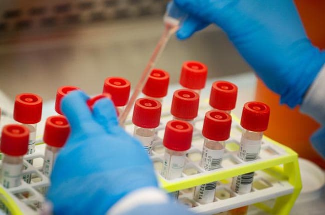 COVID-19 cases in Sri Lanka rise to 80