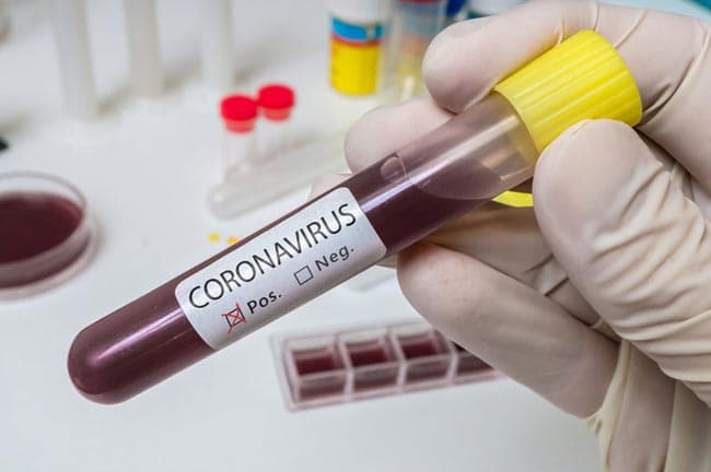 Sri Lanka’s coronavirus cases climb to 91