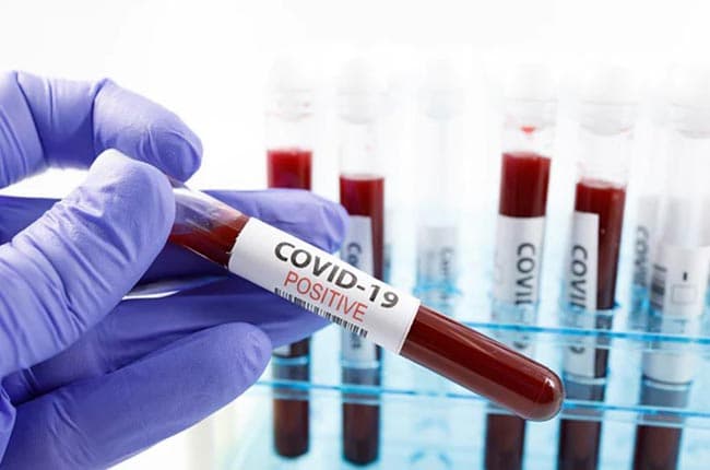 Three more COVID-19 positive patients raise total to 97 cases