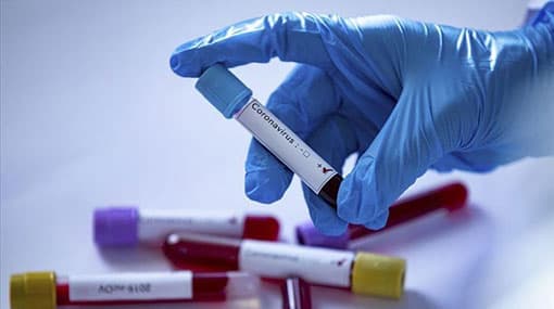 Confirmed coronavirus cases in Sri Lanka reaches 100