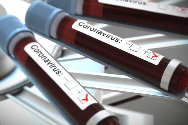 COVID-19 cases tally jumps to 142 as 10 more test positive