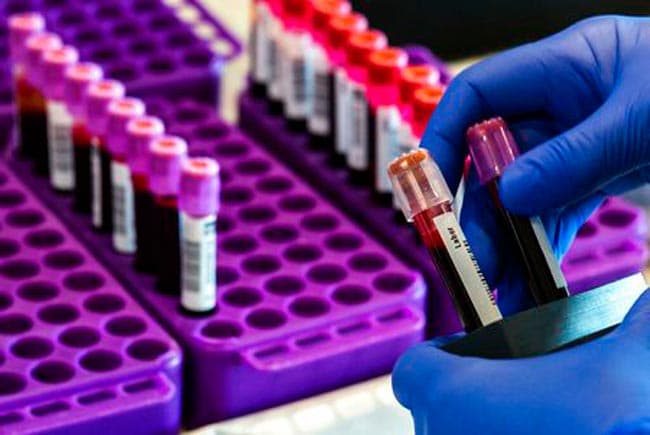 Coronavirus cases in Sri Lanka rise to 148