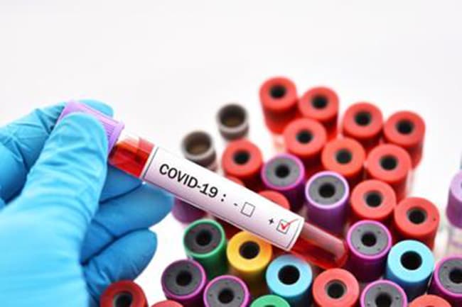 Another COVID-19 patient found; Total rises to 151