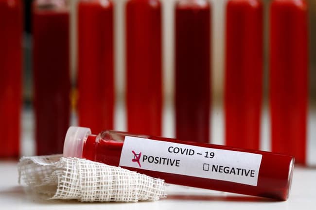 Three more COVID-19 cases raise total to 159