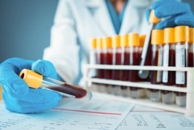 COVID-19 case count jumps to 233 with 14 new infections