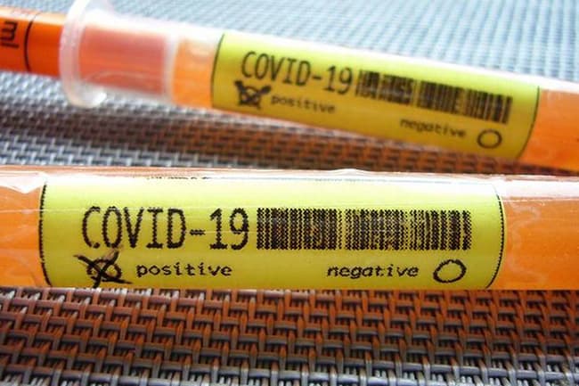 Two new COVID-19 patients found; Total rises to 271