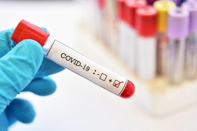 One more COVID-19 case reported; total at 304