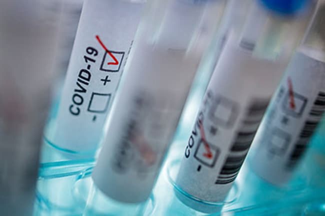 Confirmed coronavirus cases count hits 592