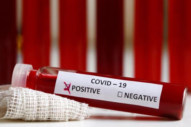 Total cases rise to 619 as eight more test positive