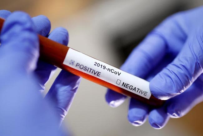 Coronavirus cases in Sri Lanka at 706
