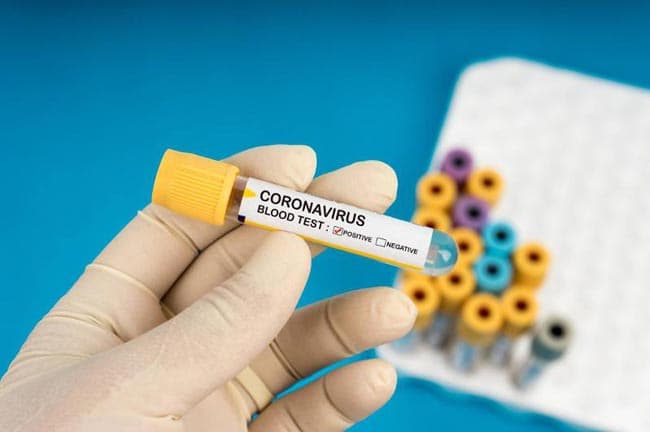 Five new COVID-19 cases raise total to 760