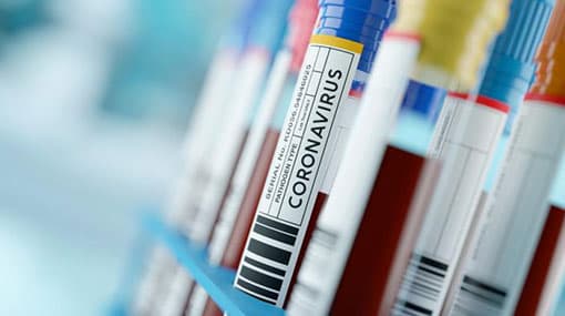 Confirmed cases of COVID-19 climbs to 765