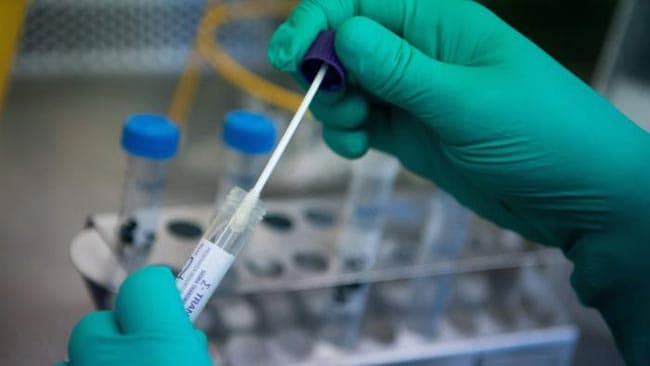 Coronavirus case count moves to 797