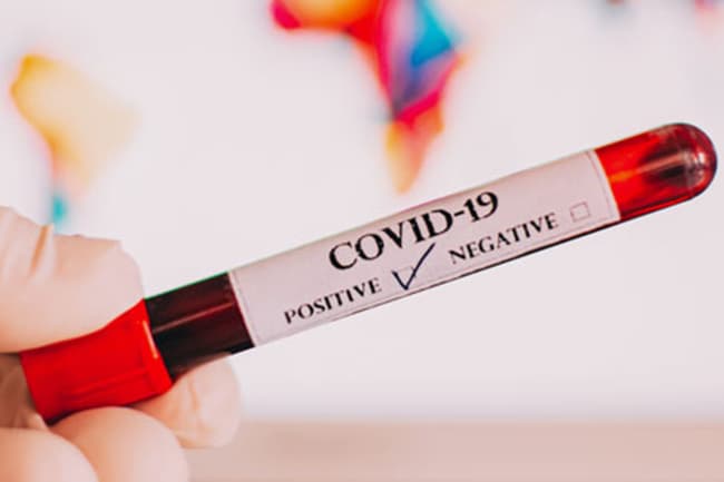 Another COVID-19 case confirmed; Total count at 856