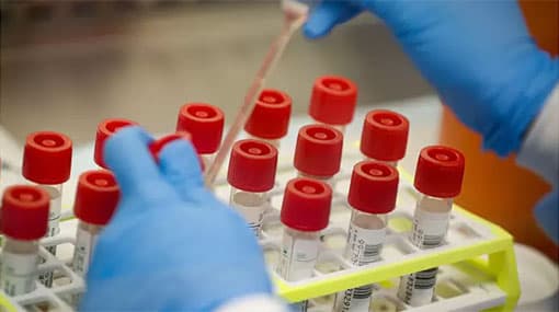 Total number of Covid-19 cases climbs to 879