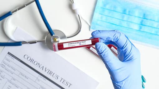 Covid-19 cases climbs to 884 in Sri Lanka