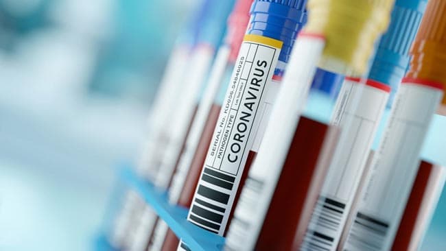 Coronavirus cases in Sri Lanka hike to 925